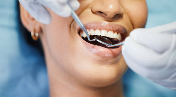 Best Emergency TMJ Treatment in Oceanside, CA