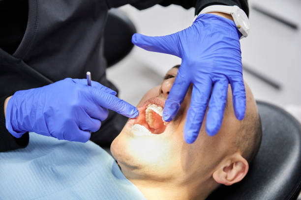 Best Emergency Dental Care for Broken or Chipped Teeth in Oceanside, CA