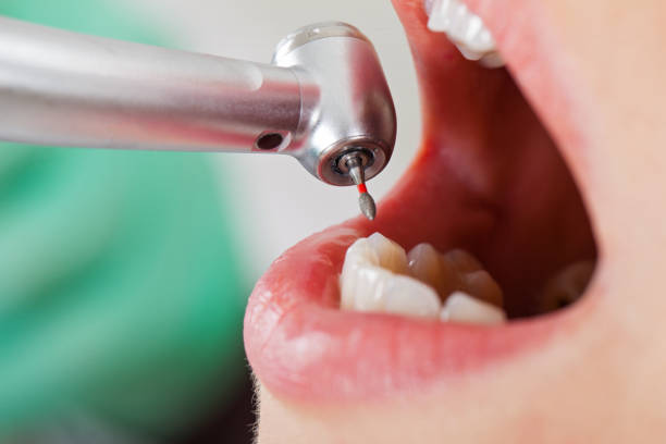 Best Emergency Gum Treatment in Oceanside, CA